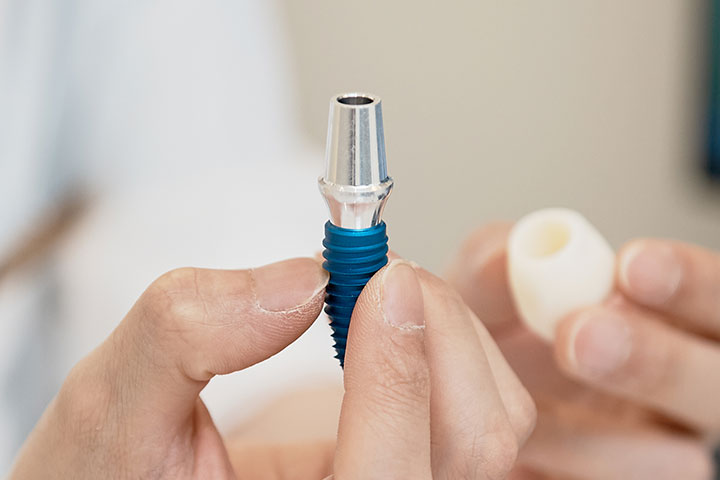 오늘의 임플란트